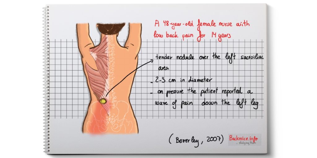 tender nodules in the low back