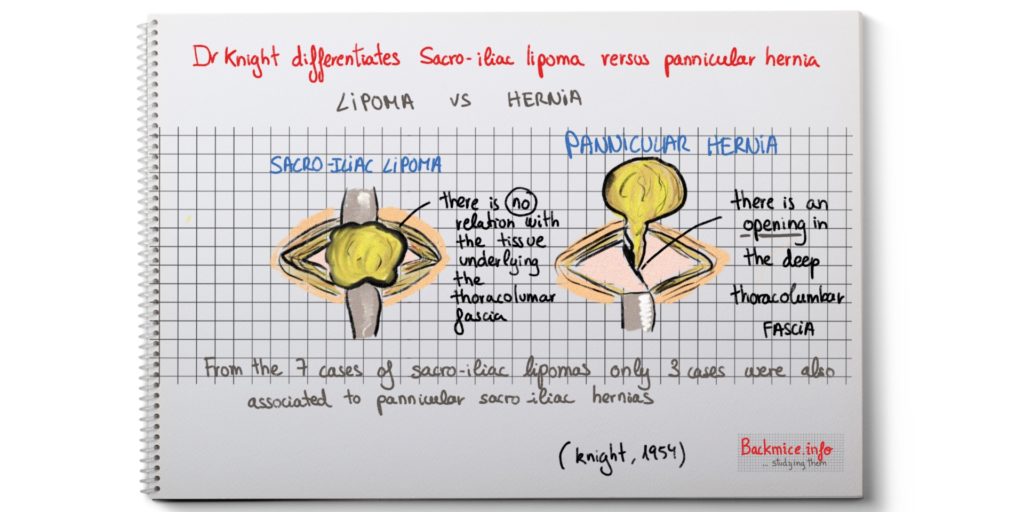 sacro-iliac lipoma