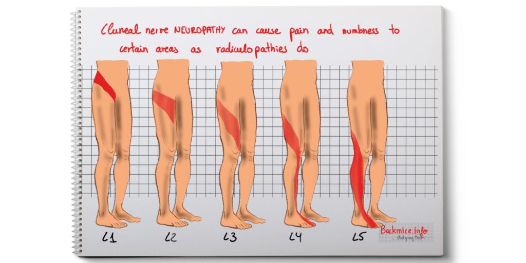 undiagnosed peripheral nerve