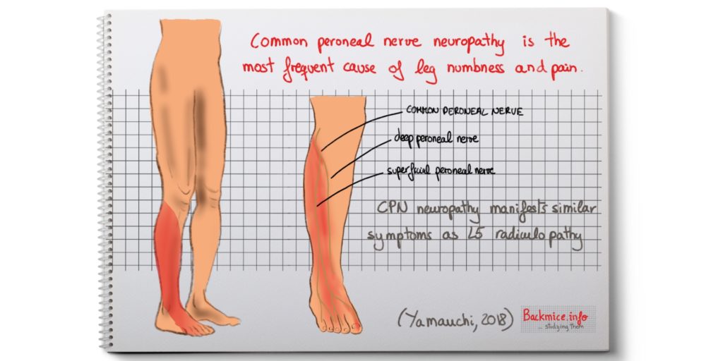 undiagnosed peripheral nerve