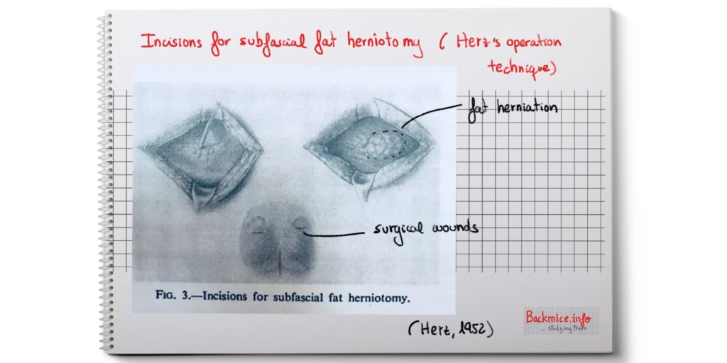 painful nodule