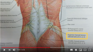 superior cluneal nerve entrapment video