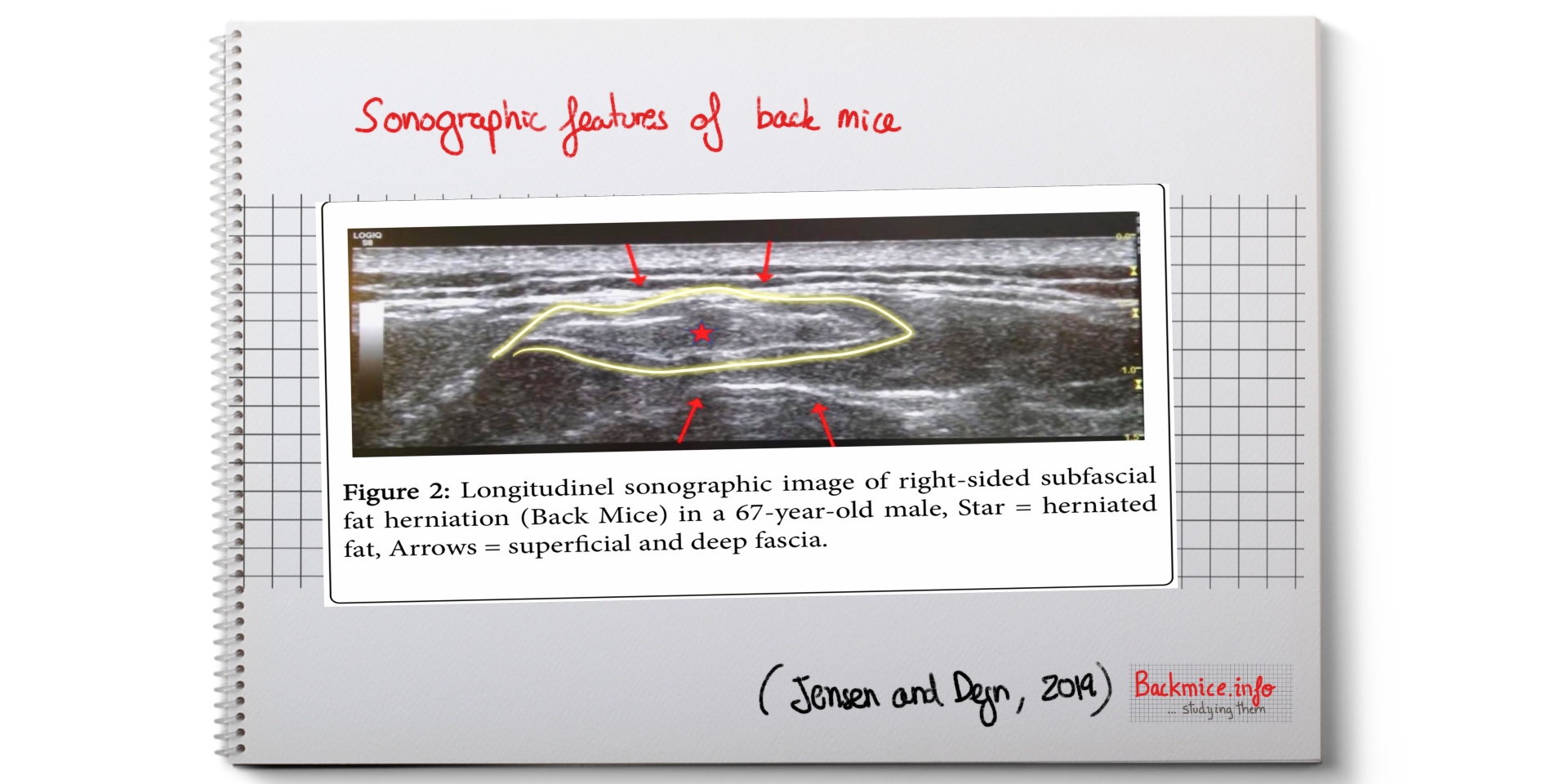 Case report: Sonographic evaluation 